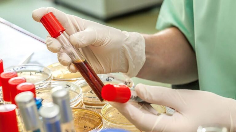 В США нашли новые доказательства присутствия SARS-CoV-2 в стране еще в декабре 2019 года